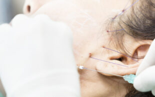 PDO Thread Case
